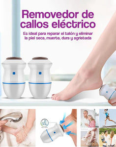Removedor Gifty NeoFeet