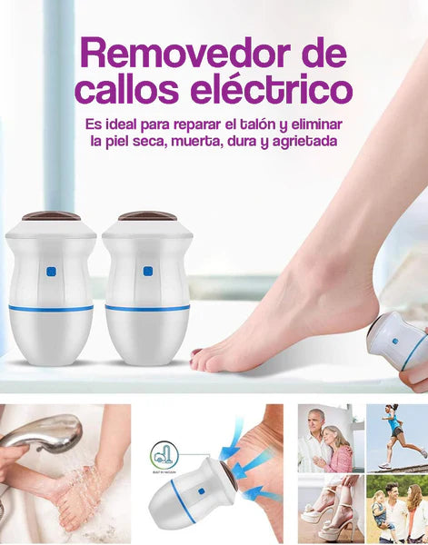 Removedor Gifty NeoFeet